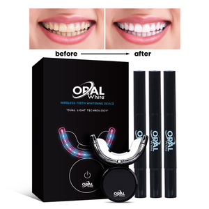 Bộ dụng cụ tẩy trắng răng bán chạy nhất, bộ dụng cụ tạ<span class=keywords><strong>i</strong></span> nhà, gel làm trắng răng 35% HP CP, ống tiêm, bộ dụng cụ làm trắng răng, logo riêng - Product Image 2