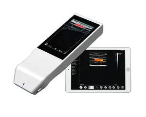Tıbbi yüksek frekanslı ekipmanları doğrusal prob kablosuz el taşınabilir renkli doppler ultrason doğrusal prob