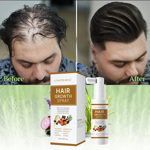Produits de croissance des cheveux, spray de croissance des cheveux, traitements de repousse des cheveux pour la vente au détail - Product Image 1