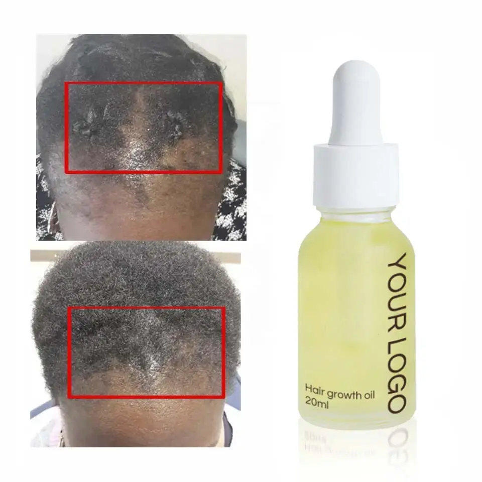 Private Label Anti-Loss-Behandlung Natürliches afrikanisches Chebe-Haarwuchs öl Chebe-Pulver Haarwuchs öl