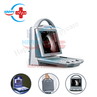 Scanner à ultrasons ophtalmique numérique complet HC-Q034A A/B, ultrasons oculaires