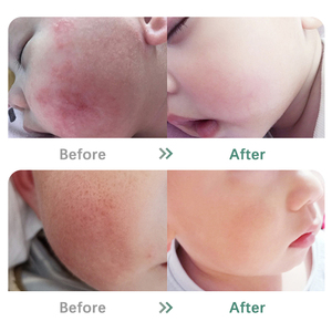 Private Label <span class=keywords><strong>naturale</strong></span> organico sensibile alla pelle Coconuttb olio <span class=keywords><strong>per</strong></span> bambini lozione <span class=keywords><strong>per</strong></span> <span class=keywords><strong>il</strong></span> <span class=keywords><strong>corpo</strong></span> nutriente <span class=keywords><strong>crema</strong></span> <span class=keywords><strong>idratante</strong></span> balsamo <span class=keywords><strong>per</strong></span> bambini - Product Image 4