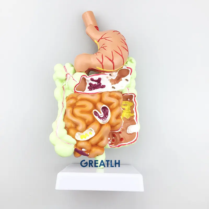 Human Digestive System Model Stomach Large Intestine Cecum Rectal Anatomy Model Teaching model