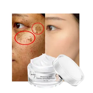 Clareamento Freckle Creme Private Label Melhor Full Face Freckle Lightening Branqueamento Dark Spot Corrector Dia Adultos Feminino OEM/ODM