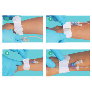 Apósito de fijación para catéter médico, adhesivo transpirable, tubo de drenaje, dispositivo de fijación para tubo de punción, PICC estéril - Product Image 1