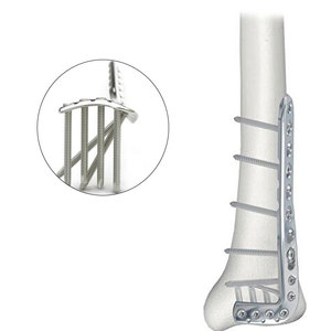 Plaque de blocage tibiale proximale distale médiale latérale manuelle en titane et acier inoxydable avec trous orthopédiques pour implants osseux distal médial - Product Image 6