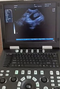 Mesin Pemindai Ultrasonografi Veteriner untuk Perut dan Jantung untuk Toko Perlengkapan Hewan Peliharaan Peralatan Ultrasonografi - Product Image 5