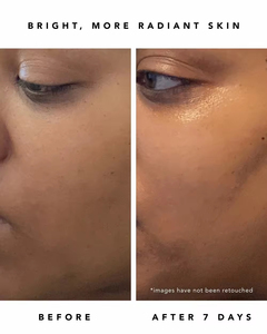 Doğal yeni cilt bakımı serumu yüz 15% C vitamini + zerdeçal Serum Anti-Aging renk açıcı Serum - Product Image 5