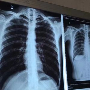 فيلم أشعة إكس أزرق ليزر نافث للحبر - Product Image 5