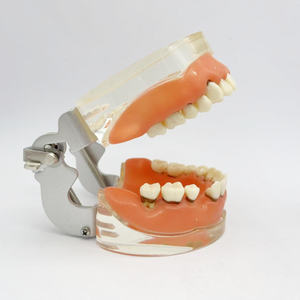 Parodontitis Model Medische Wetenschap Tandheelkundig Model Voor Opleiding In Scholen En Ziekenhuizen - Product Image 5