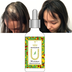 Manufacturer Hair Growth <strong>Oil</strong> 100% Natural Herbal Organic Rosemary <strong>Scalp</strong> Elixirs Care Loss Treatment - Product Image 1
