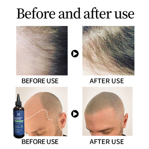 OEM Private Label 200ml Haarwuchsöl Haarvitalitäts-Booster Kopfhaut-Reparatur Kräuter-Rosmarin Haarwuchsöl Sanftes Haarwuchsöl - Product Image 4