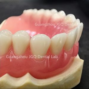 ฟันปลอมอะคริลิกคุณภาพสูงแบบสั่งทำพิเศษ ช่วยฟื้นฟูการทำงานและรูปลักษณ์ของฟันให้กลับมาเป็นธรรมชาติ - Product Image 4