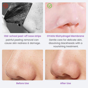 แผ่นแปะจมูกควบคุมความมันแผ่นแปะจมูกกำจัดสิวบรรเทาสิวทีโซนดูแลจมูก - Product Image 5