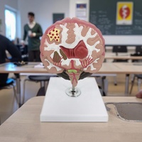 Modèle médical de pathologies cérébrales, modèle anatomique de maladies du cerveau pour l'enseignement médical, affichage des structures pathologiques, CE ROHS ISO