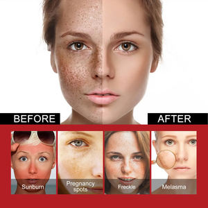 L'ultima versione della Thailandia di <span class=keywords><strong>crema</strong></span> nutriente per il <span class=keywords><strong>viso</strong></span>, rimozione delle macchie nere, <span class=keywords><strong>crema</strong></span> per la cura del <span class=keywords><strong>viso</strong></span> <span class=keywords><strong>rimpolpante</strong></span> e <span class=keywords><strong>rassodante</strong></span> - Product Image 6