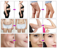 Rouleau de massage anti-cellulite 5 en 1 à pression négative, masseur à billes interne, rouleau à vide, machine esthétique pour amincir le corps et éliminer la cellulite