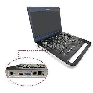 Escáner de Ultrasonido <span class=keywords><strong>Doppler</strong></span> Color Portátil de 15.6 Pulgadas 24-SYA-SN50C para Abdomen, Cardíaco y Vascular - Product Image 2