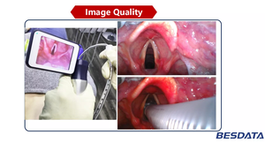 BESDATA lame de laryngoscope vidéo électrique pas cher prix outil d'intubation en acier réutilisable pour la gestion des voies respiratoires - Product Image 4