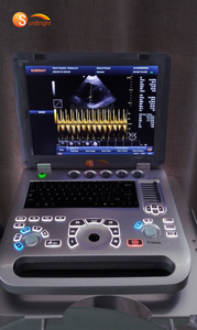 Échographe médical électrique 2D de haute qualité, <span class=keywords><strong>portable</strong></span>, avec écran LCD de 15 pouces - Product Image 6