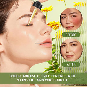 ホットセール卸売 エッセンシャルオイル オーガニック カレンデュラオフィシナリスオイル 肌・顔のケア用 <span class=keywords><strong>100</strong></span>%ピュアオーガニックカレンデュラオイル - Product Image 3