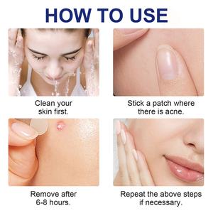 Parches Hidrocoloides para el Acné, 78 Unidades, Venta al por Mayor de Fábrica, Adhesivos para Granos y Espinillas Faciales - Product Image 4