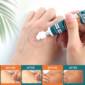 Gel Réparateur de Cicatrices Cutanées aux Herbes Naturelles OEM Efficace pour l'Élimination des Vergetures Crème de Soin - Product Image 3