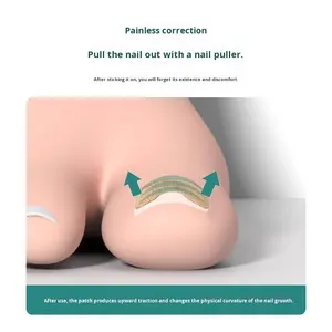 เครื่องมือแก้ไขรูปแบบ G3D11แบบไร้กาวขอบสำหรับเล็บเท้าแผ่นตัดเล็บเนื้อคุดแบบไม่มีร่อง - Product Image 3