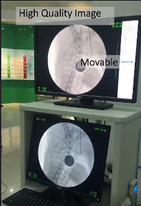 Vet dentaire x ray 5kw chirurgie vétérinaire c-bras xray animal radiologie C bras mobile vétérinaire x ray machine pet c bras x ray machine - Product Image 3