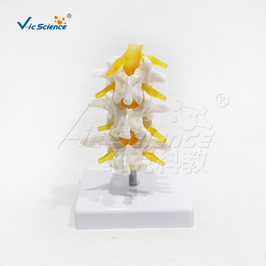 Modèle de vertèbres lombaires à trois segments de haute précision, en PVC, avec structure précise ; une démonstration de pathologie - Product Image 3