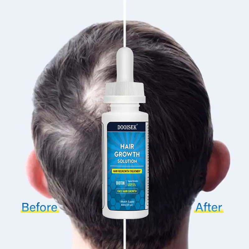 Wholesale Fast Effective Biotin 10% Hair Growth Essential Oil Anti Hair Loss Hair Growth Serum Set Care Private label