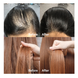 Aceite <span class=keywords><strong>para</strong></span> <span class=keywords><strong>el</strong></span> crecimiento del cabello, productos <span class=keywords><strong>para</strong></span> <span class=keywords><strong>el</strong></span> crecimiento del cabello <span class=keywords><strong>para</strong></span> mujeres negras, suero <span class=keywords><strong>para</strong></span> <span class=keywords><strong>el</strong></span> crecimiento del cabello con rodillo - Product Image 6