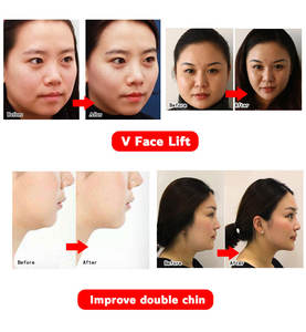 ขายส่งราคาขนาด S <span class=keywords><strong>M</strong></span> L ใบหน้ายืดหยุ่นใบหน้ากระชับสัดส่วนผ้าพันแผลคู่คางสายคล้องหน้า V สายหน้ากากเชียร์ใบหน้า - Product Image 6