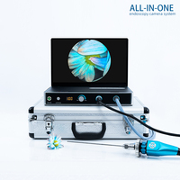 Caméra endoscopique médicale Processeur vidéo Caméra endoscope portable pour ORL Arthroscopie Gynécologie vétérinaire Urologie