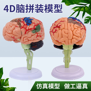 Cerveau 4D assemblé, modèle de cerveau humain détachable, anatomie du cerveau, vaisseaux sanguins cérébraux, artères, matériel pédagogique de neurologie - Product Image 4