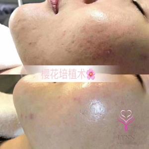 <span class=keywords><strong>Cosmelan</strong></span> <span class=keywords><strong>2</strong></span> Crème Visage | Dissolvant Taches Noires, Taches de Rousseur et Pigmentation pour Blanchir Tous Types de Peaux - Product Image 3