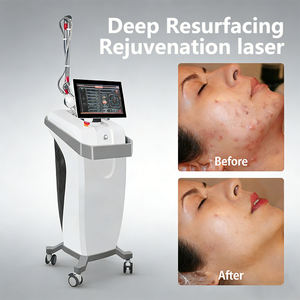 Máquina de Belleza para el Cuidado de la Piel con Láser Fraccional de CO2 de 10600nm, Máquina de Láser Fraccional de CO2 con Radiofrecuencia, Ultra Super Pulso, Tensado Vaginal de la Piel - Product Image 6