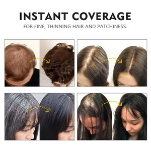 NIZORICK 30g Fibras Capilares de Queratina Natural para Cabello Fino, Polvo Voluminizador Instantáneo, Corrector, Fibras Capilares de Marca Privada - Product Image 5