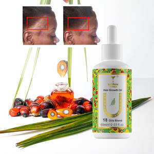 18 масел смесь масла для роста волос с маслом розмарина перечной мяты стимулирует фолликулы настраиваемый Private Label - Product Image 5