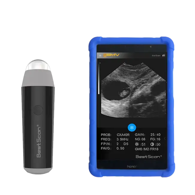 BestScan S3 3.5/5.0Mhz, prix de la sonde à ultrasons sans fil/Mini appareil à ultrasons/Ipad Iphone