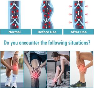 Tất y tế bó đùi cao, ngón chân mở, độ nén 15-21 mmHg, chất liệu mờ, dùng cho phù nề, giãn tĩnh mạch, sưng tấy - Product Image 6