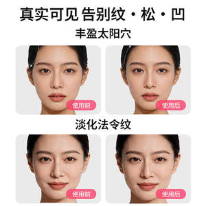 Masseur facial pour le cou, raffermissant, améliorant la ligne V, masseur musculaire facial, réduction des pattes d'oie, des plis nasogéniens - Product Image 5