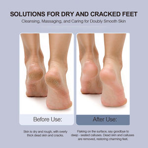 자동 가정용 충전식 전기 발 각질 제거기 - Product Image 3