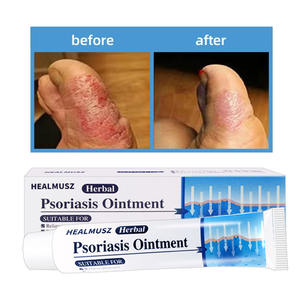 Extracción de hierbas chinas Dermatitis Psoriasis Ungüento Picazón Peeling Eczema Ungüento antifúngico Cuidado DE LA SALUD - Product Image 3