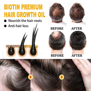 Huiles capillaires et shampoings à base de plantes pour la croissance des cheveux, produits de traitement pour la repousse du cuir chevelu, toniques essentiels pour les soins capillaires naturels (Marque Blanche) - Product Image 2