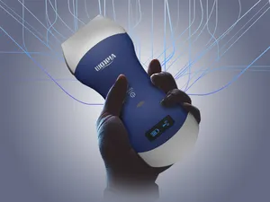Viatom Draadloze Sonosite Dual Scan Probe Diagnostic Ultrasound Machine Draadloze