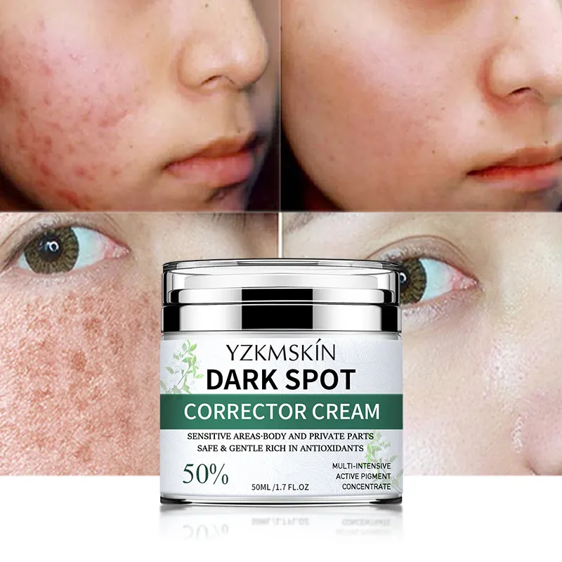 Strong Bleaching White ning Face Sommersprossen Entfernen Sie Pickel Melasma Makel Entfernung Dark Spot Remover Corrector Cream