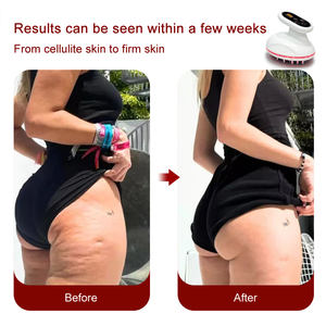 Smart 4 in 1 Gesichts skulptor Anti-Aging Hauts traffung Falten reduzierung werkzeug Körper massage gerät - Product Image 5