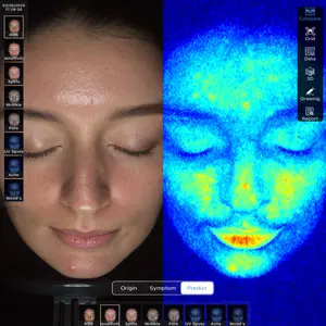 Meicet MC10 Portable Multi UV Woods Light Facial Skin Image Analysis Machine Skin Analyzer Face Scanner For Beauty Center