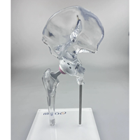 Modèle d'implant de hanche transparent KyrenMed, modèle de remplacement, mini taille, modèle d'affichage générique transparent